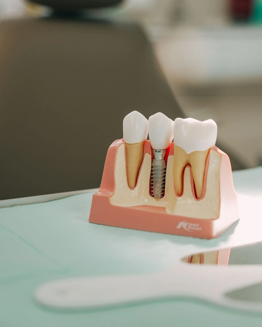 Implant 